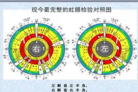 虹膜可将身体各脏腑的生理和病理整体依存关系划分得精细入微,从而更