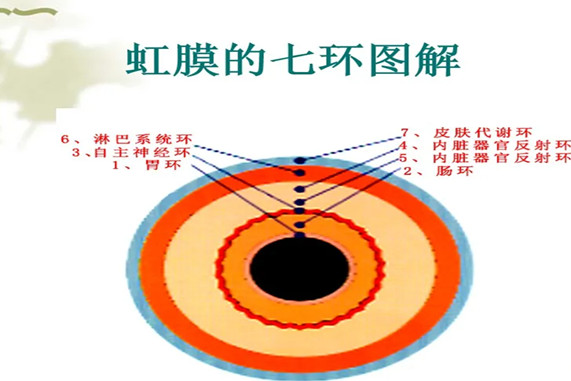 网络热议虹膜师是什么报名条件及报名通道