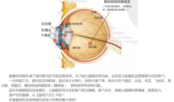 白内障示意图图片